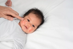 Bagaimana Cara Alami Menghilangkan Bekas ASI di Pipi Bayi?