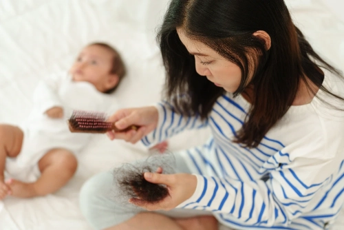 5 Penyebab Rambut Rontok Setelah Melahirkan