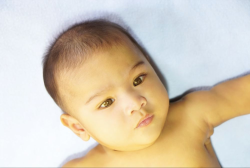 Apa Arti Sklera Ikterik? Panduan Moms Memahami Mata Bayi yang Tampak Kuning