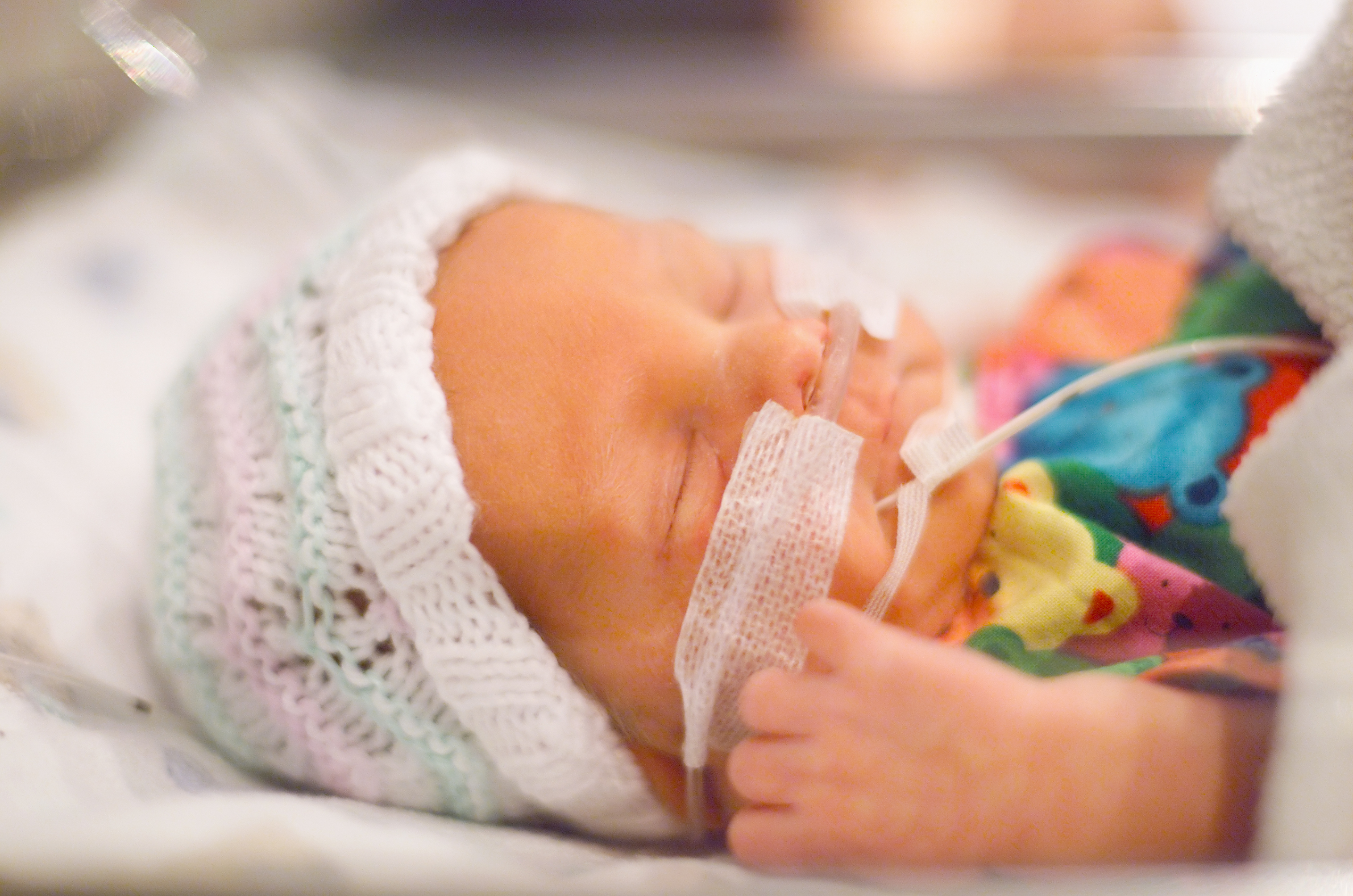 Waspada Bayi Lahir Prematur akibat Preklampsia