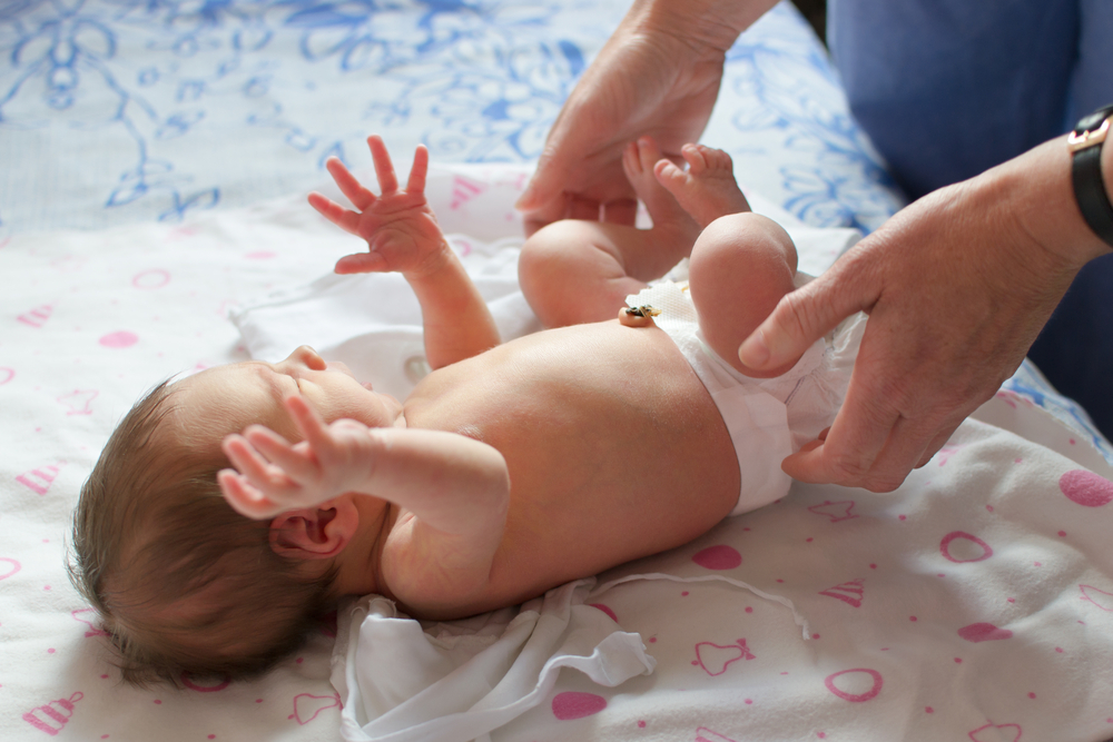 Apakah Perlu Hernia pada Bayi Dioperasi?