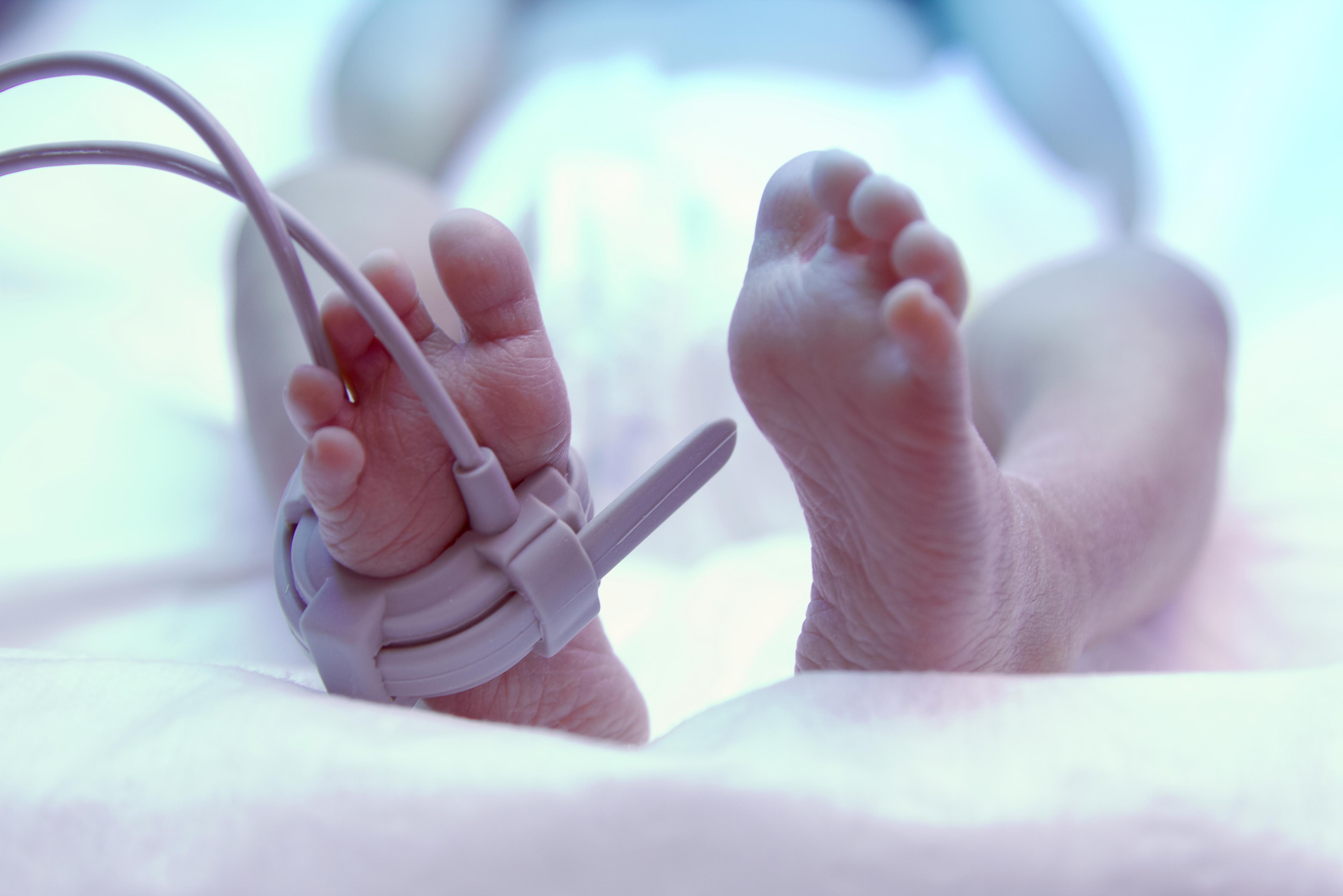 Cara Mencegah Bayi Lahir Prematur